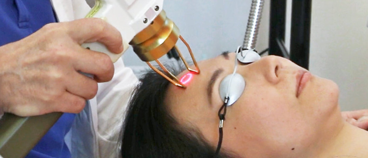 Fractional EG Laser Gesicht mit Brille und Laser mit rotem Strahl