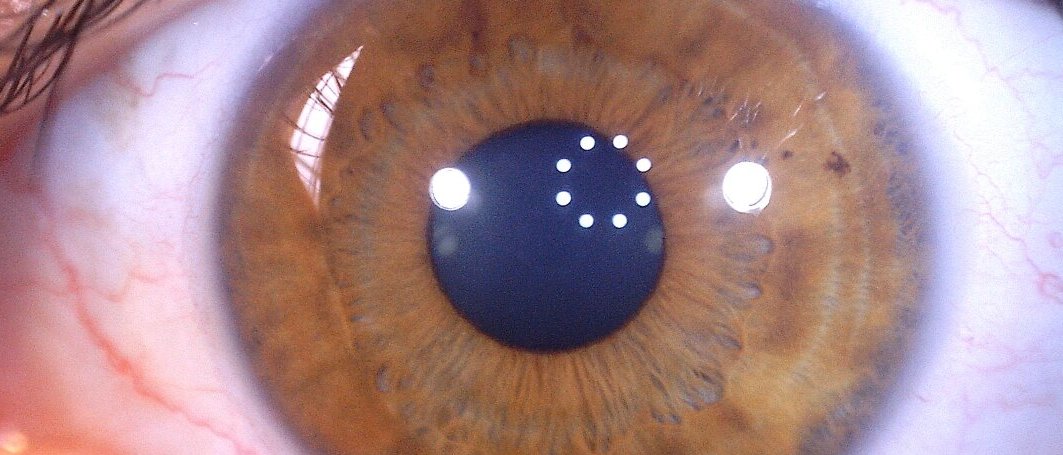 Braune Iris mit Kontur vom Auge von Marijana Stevanovic